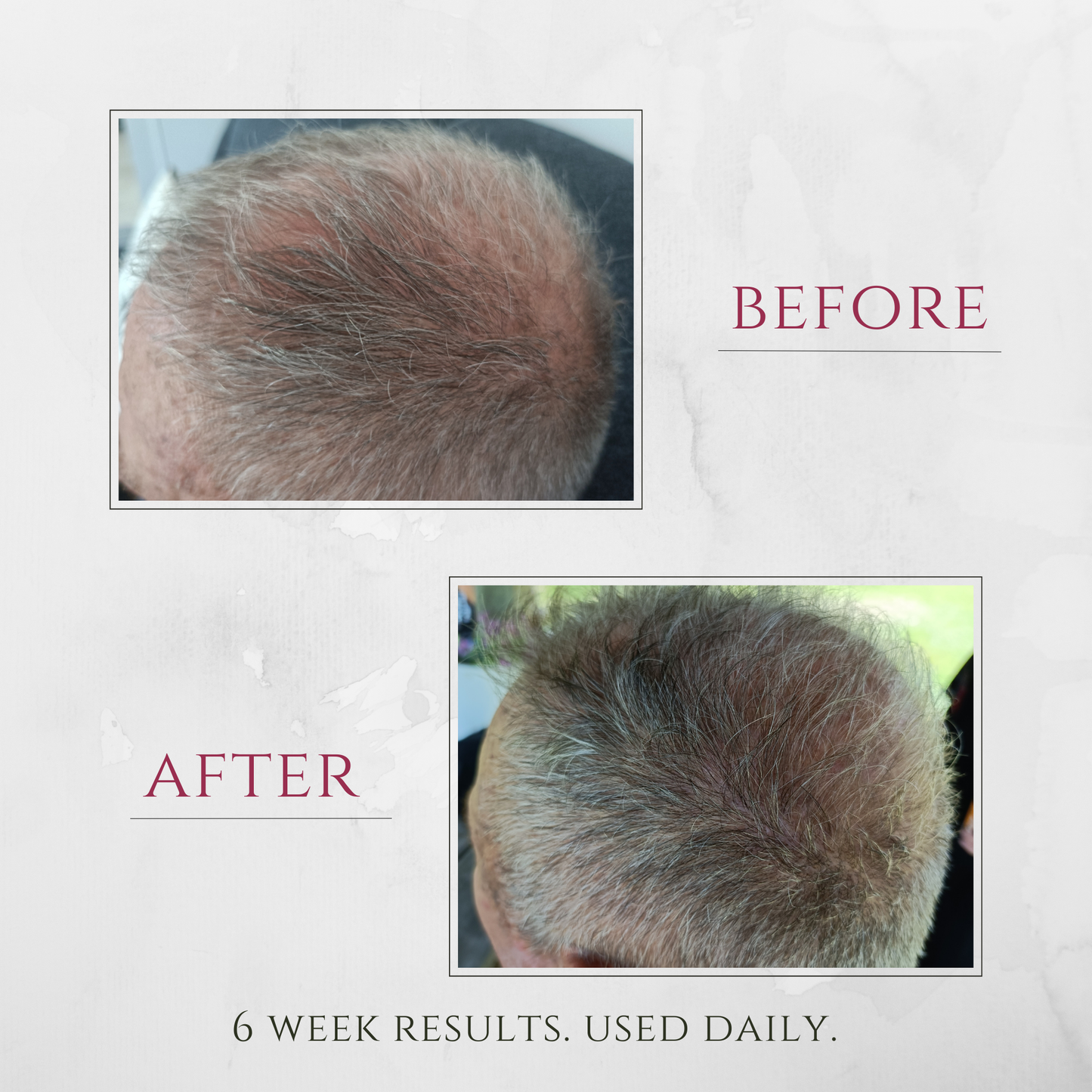 Rosemary and Caffeine Scalp Spray 100ml